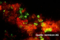 Neue Methoden des mikrobiologischen Abwassermonitorings